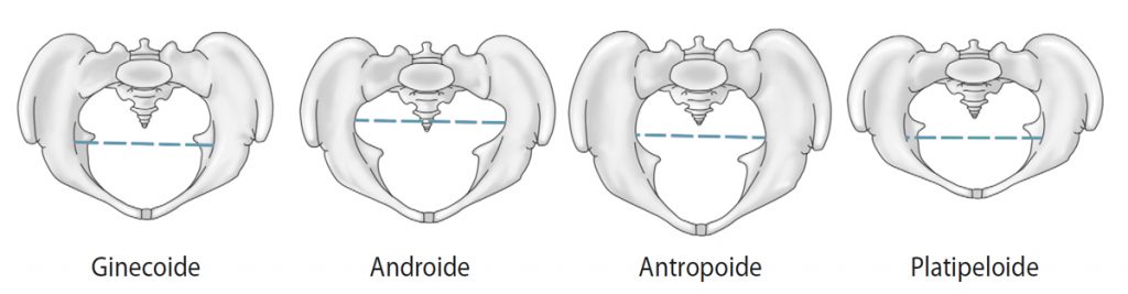 4 Tipos De Pelvis